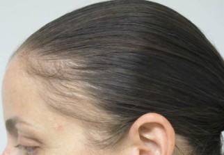 Как зафиксировать волосы за ушами