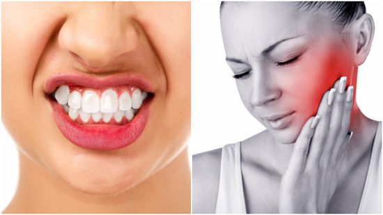 Do You Grind Your Teeth At Night Heres How To Get Relief