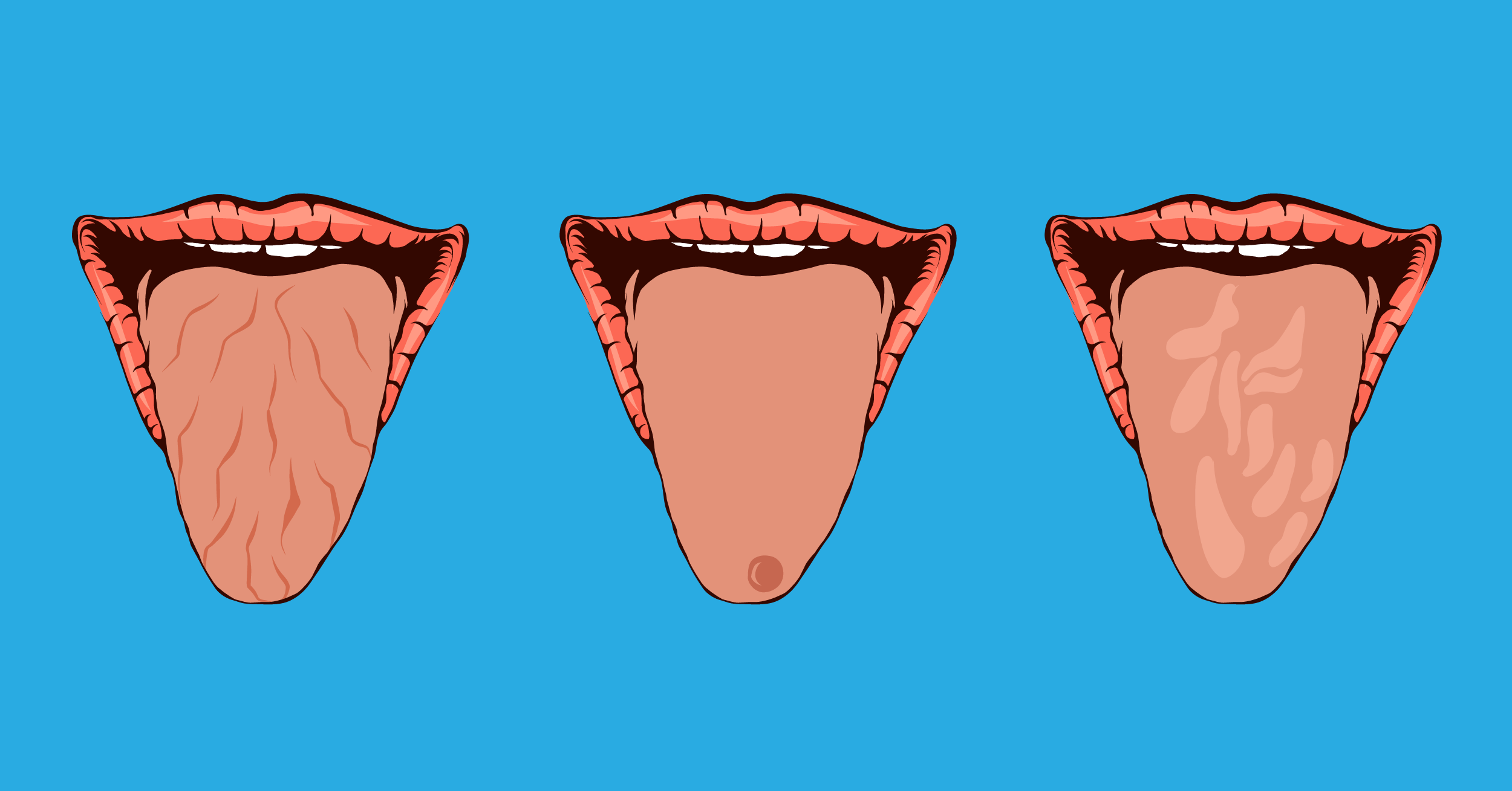 9 Secrets Your Tongue Can Reveal About Your Health