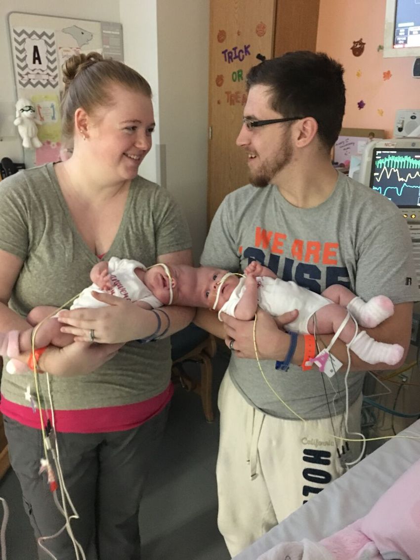 5 Months After Life Changing Surgery, Former Conjoined Twins Are