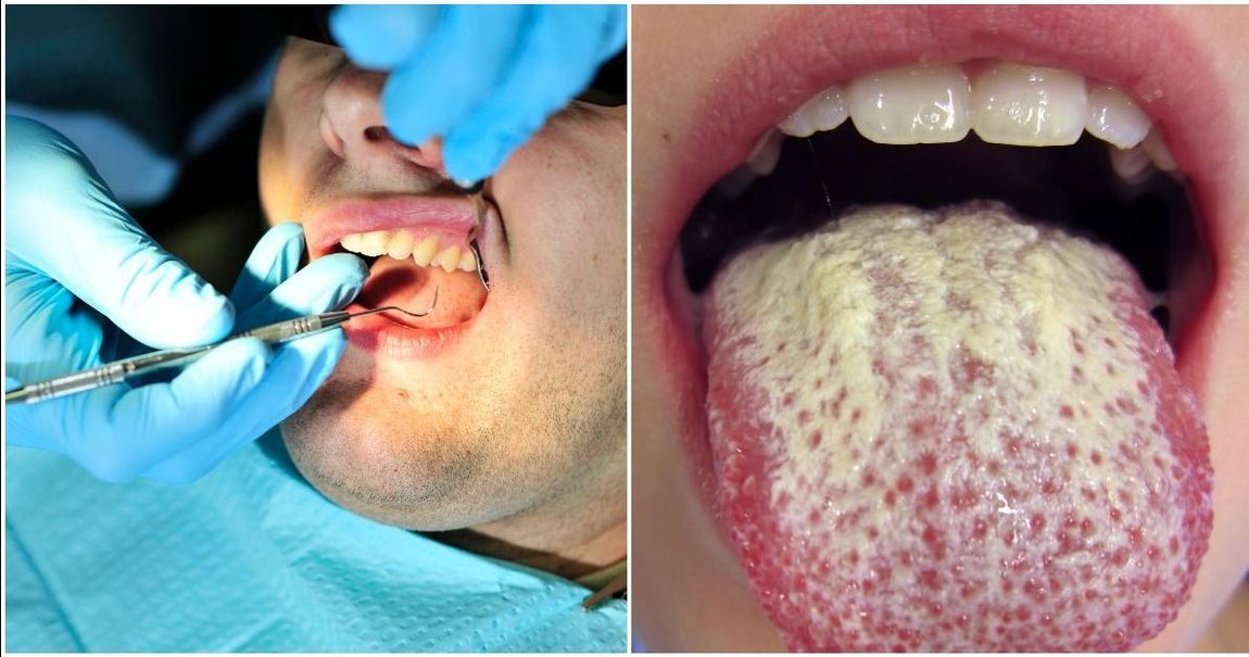 Don't To Floss 11 Seriously Nasty Side Effects Of Not Brushing