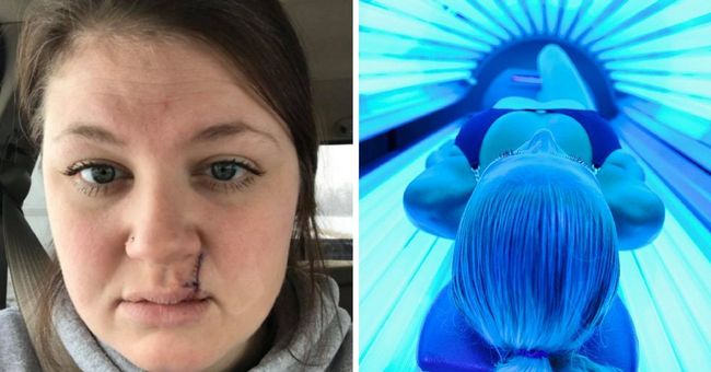 Womans Selfie Showing What Tanning Beds Did To Her Face Goes Viral