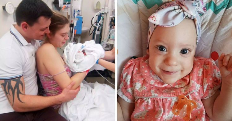 Baby Born With Underdeveloped Brain Defies The Odds By Celebrating ...