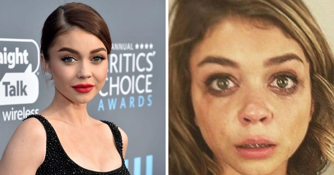 Sarah Hyland Shares Photos Of Swollen Face After Being Hospitalized