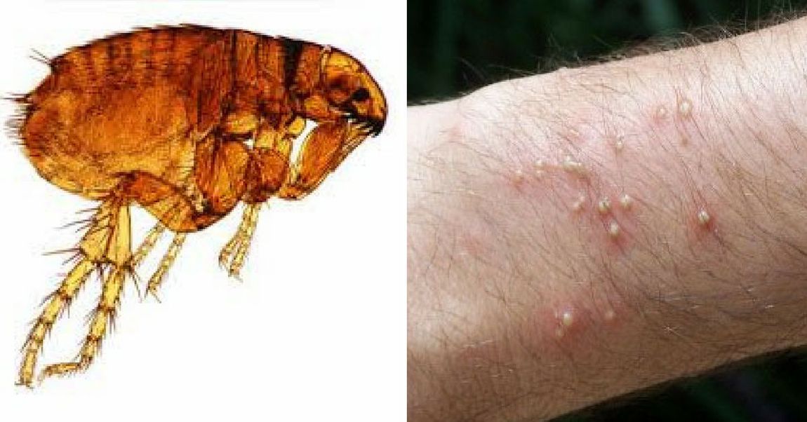 do flea bites itch on humans