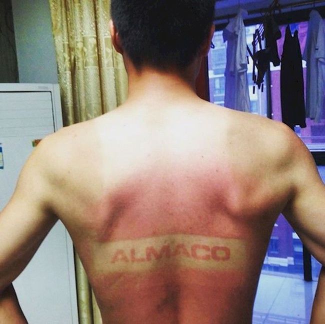 20 Hilarious Tan Lines That'll Make You Never Want To Step Outside Again