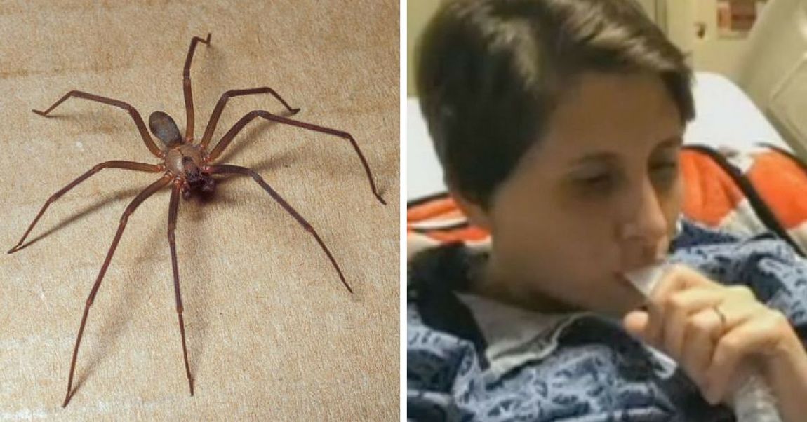 Woman Recovering From Bite After Finding 50 Recluse Spiders In Her Bedroom 8247