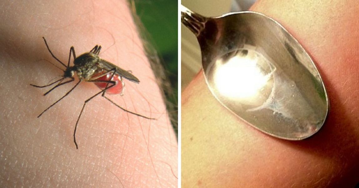 does heat stop mosquito bite itch