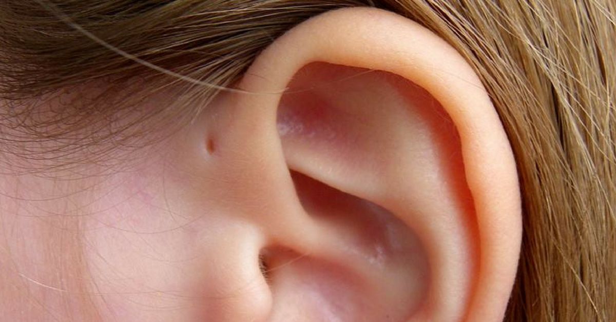 If You Have A Tiny Hole Above Your Ear Heres What It Means 2607