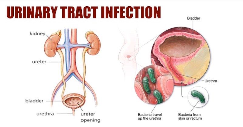 Here s What Can Go Wrong If You Hold In Your Pee