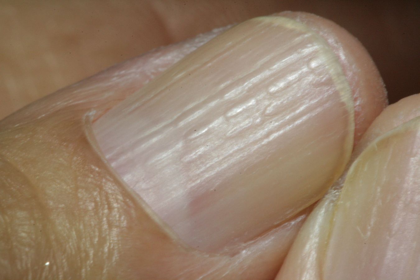 8-things-your-fingernails-can-reveal-about-your-health