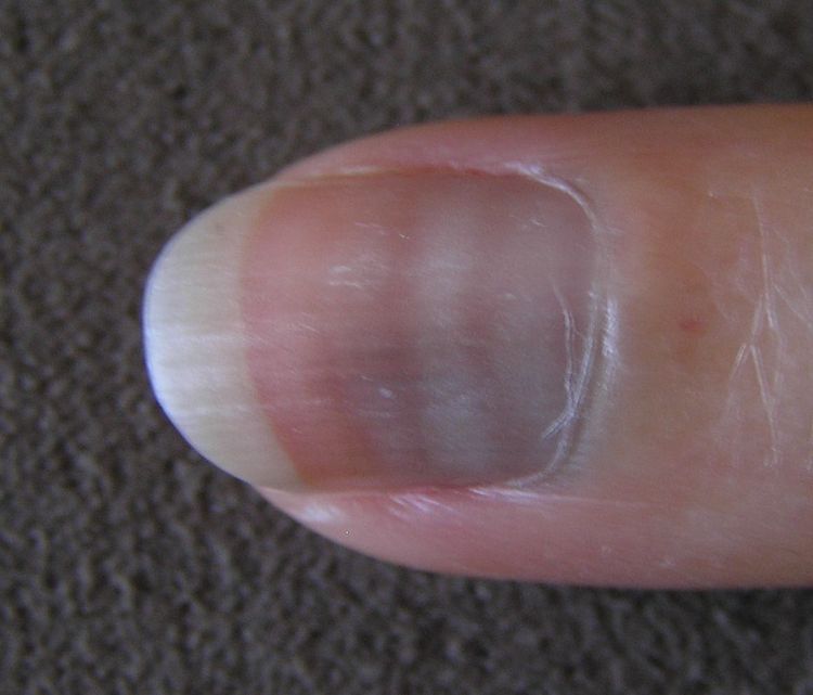 8-things-your-fingernails-can-reveal-about-your-health