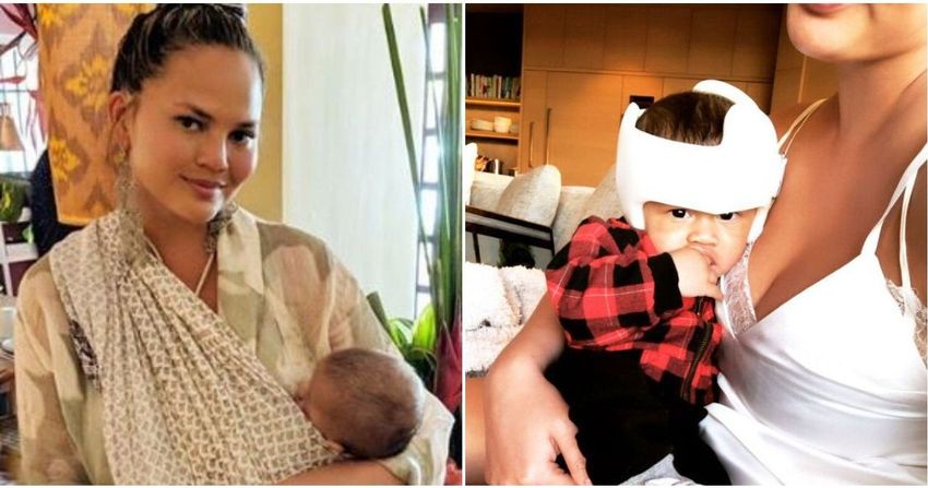 Chrissy Teigen Shows Off Baby Miles' New Headgear In A Health Update