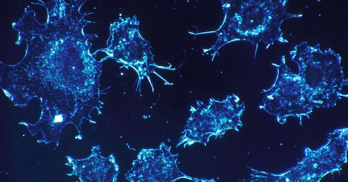 Israeli Scientists Say They Have The Cure For Cancer
