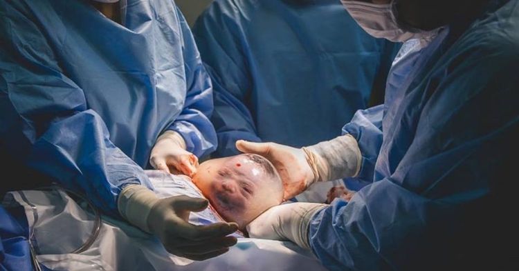 photo-captures-stunning-images-from-a-birth-that-only-happens-once-in