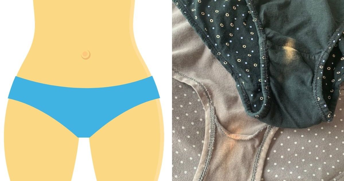 Ever noticed a bleached patch in your panties? Your vagina is to